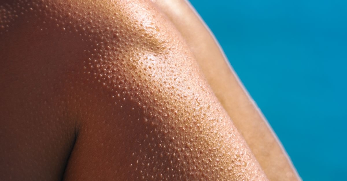Adieu boutons après l’épilation : prévenir et calmer la folliculite en douceur