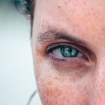 Mélasma du visage : les meilleures solutions pour atténuer les taches et retrouver un teint uniforme